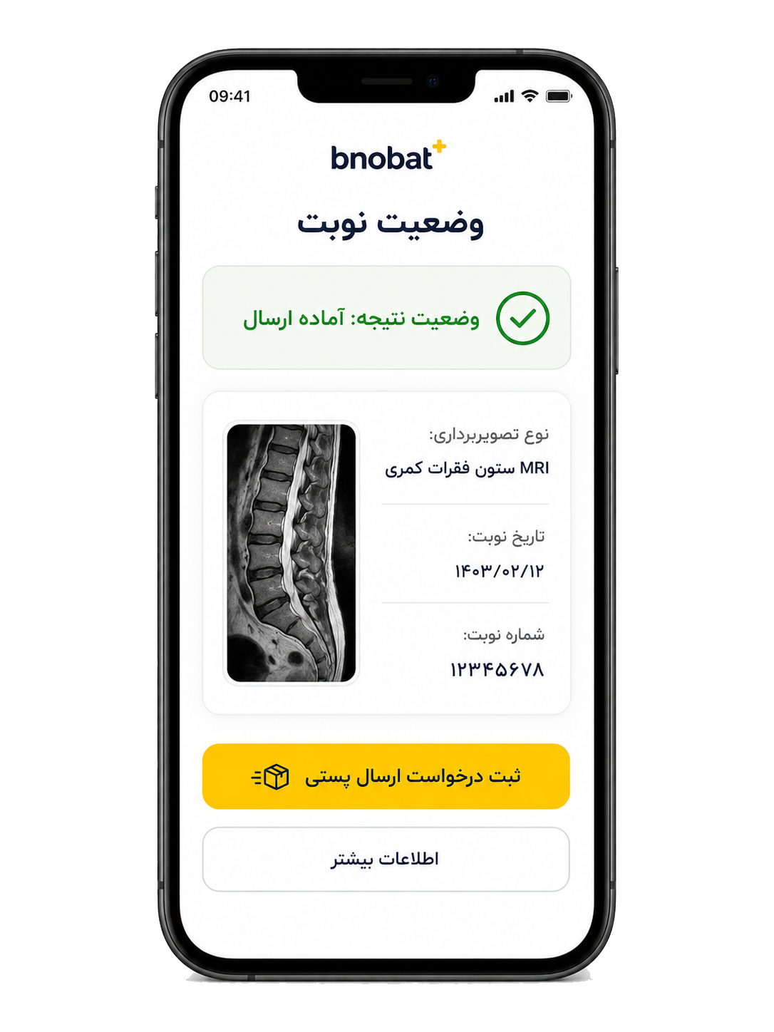 پیشنمایش وضعیت نتیجه و ثبت درخواست ارسال پستی در بینوبت